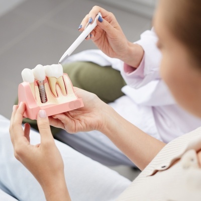 Dental implants service photo