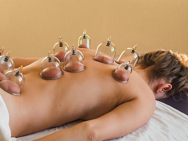 Cupping massage therapy session at Acu Room