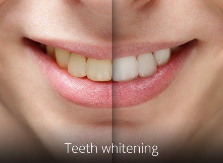Adel Dental Practice treatment and care