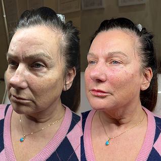 Aesthetic treatment room at Amica Aesthetics