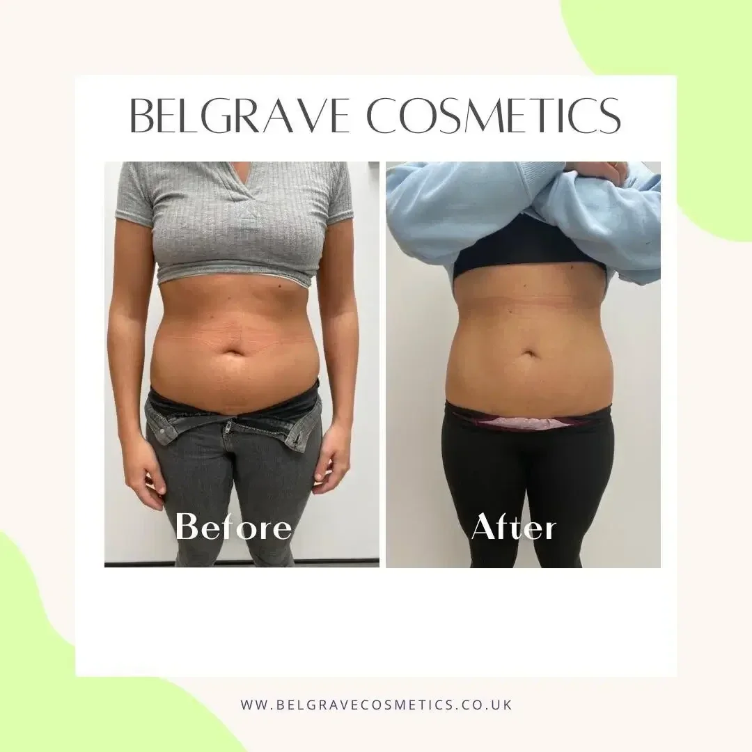 Body sculpting service image