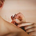 Dry needling therapy