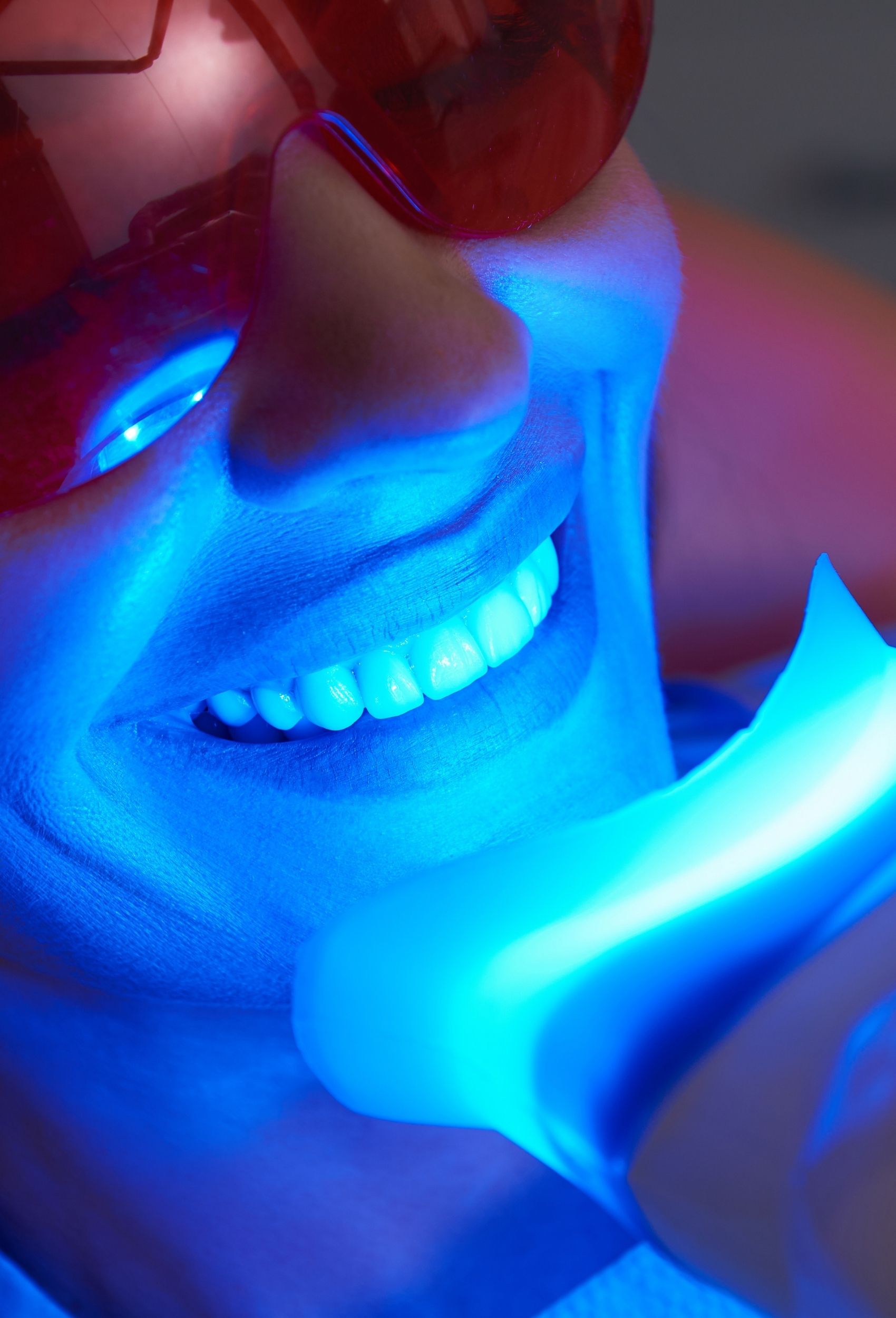Teeth whitening treatment at Charlestown Dental Practice