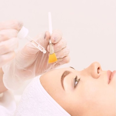 chemical peels at best skin clinic in Bristol