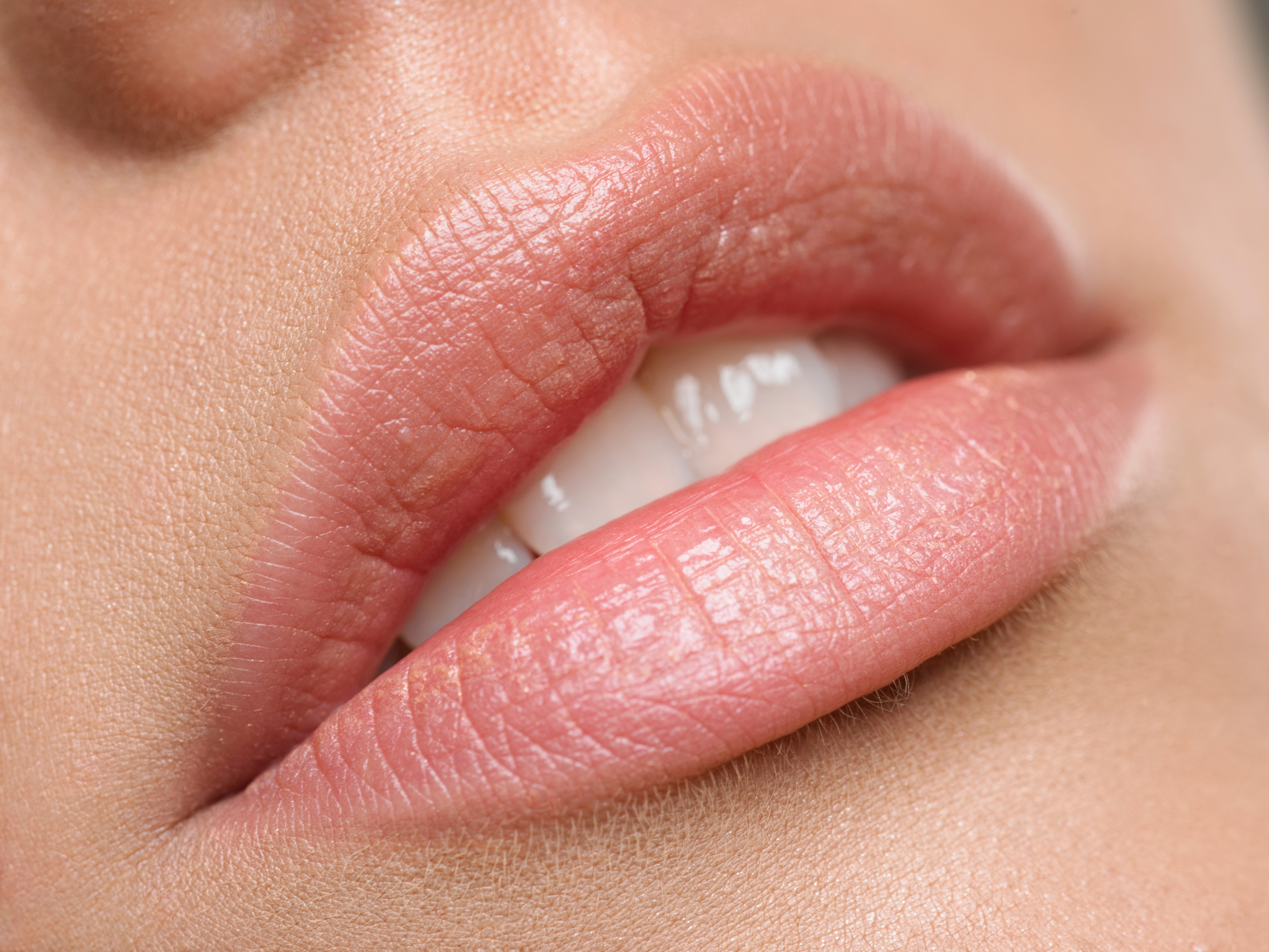 DermaClinic Bristol treatment / gallery photo