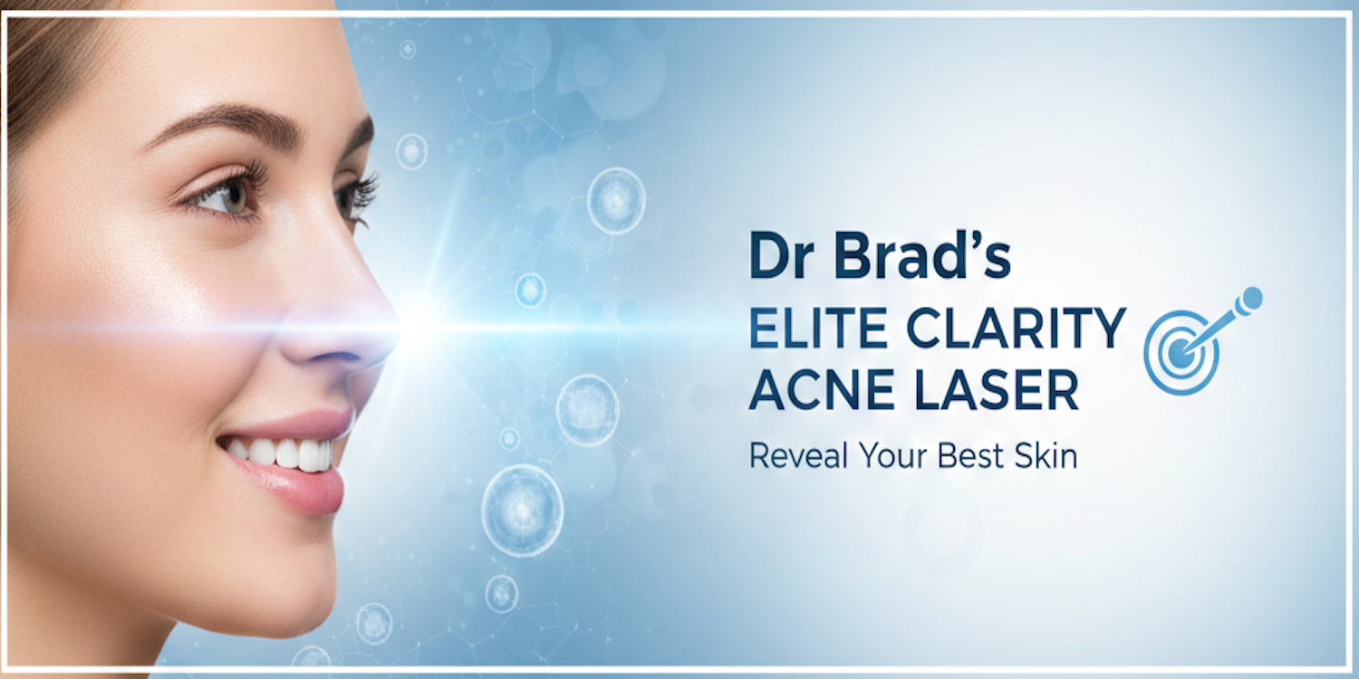 Elite Clarity acne laser treatment
