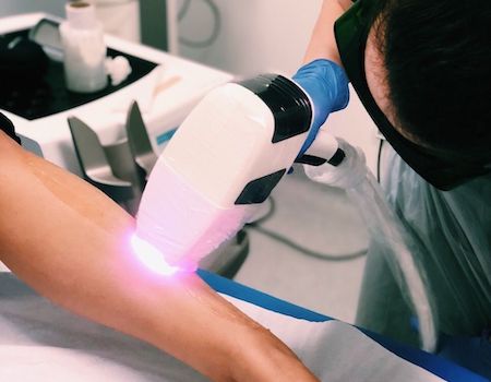 Laser hair removal treatment at Good Skin Days