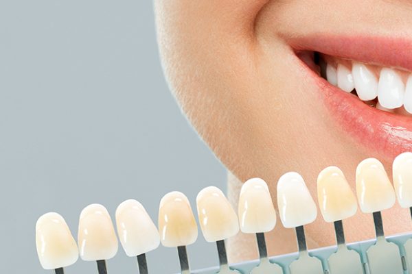 Teeth whitening treatment at Gorton Dental Practice