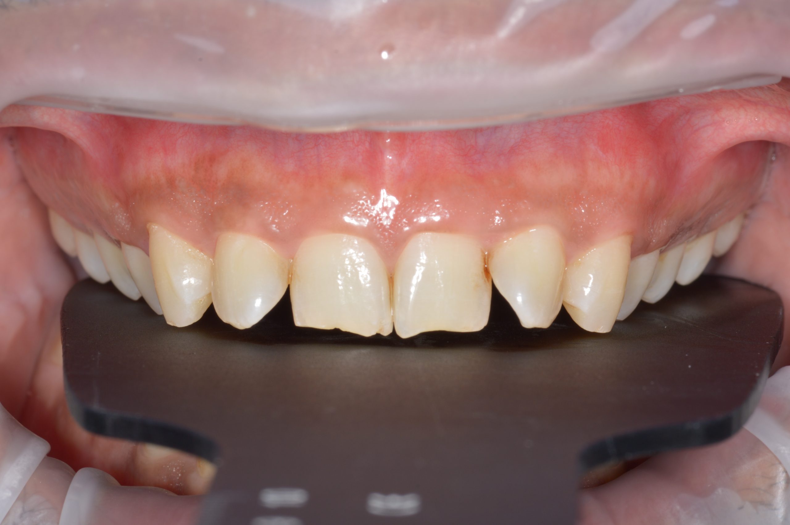 Inside Horsforth Smile Clinic