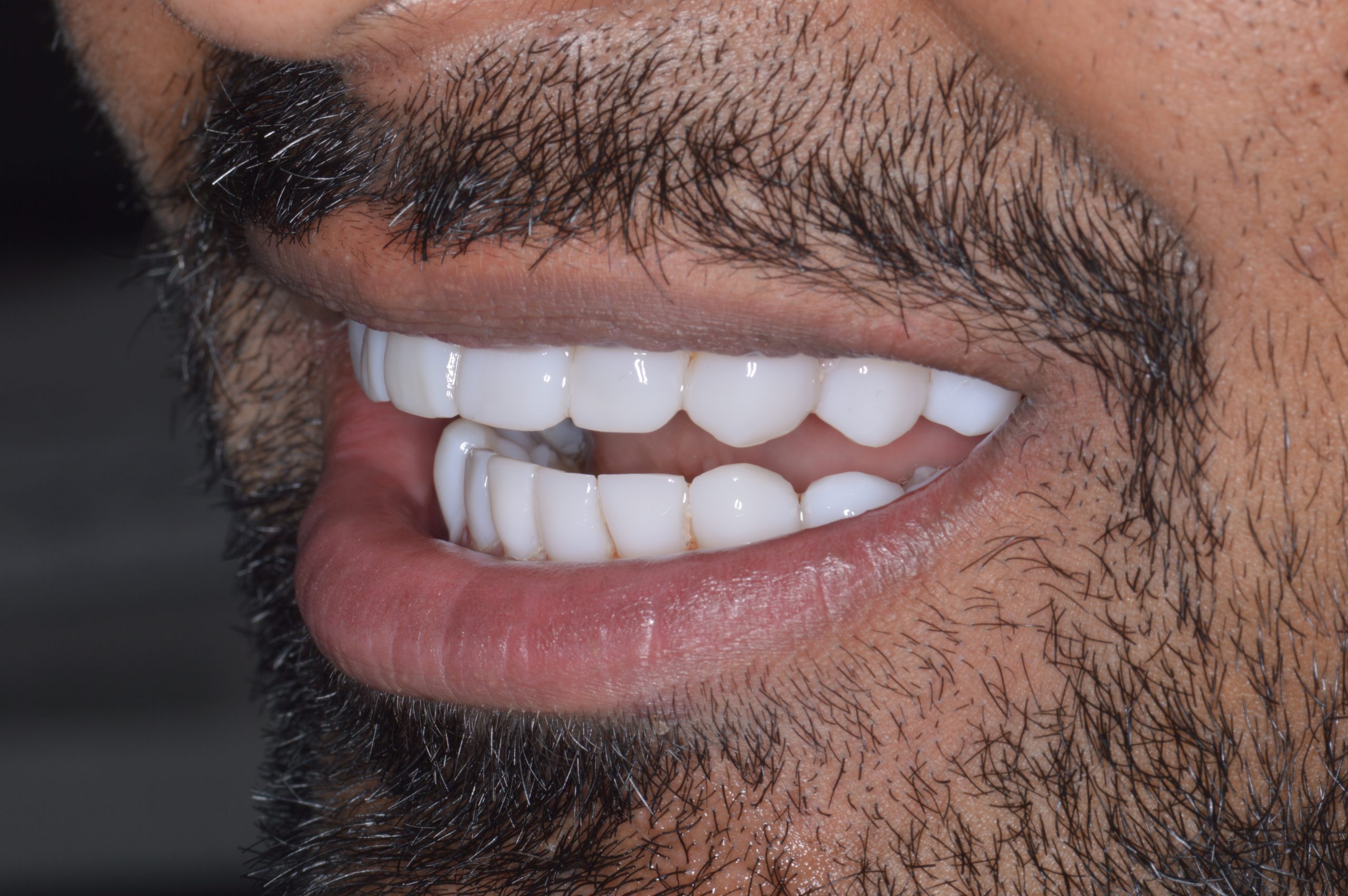 Horsforth Smile Clinic treatment room and dental suite