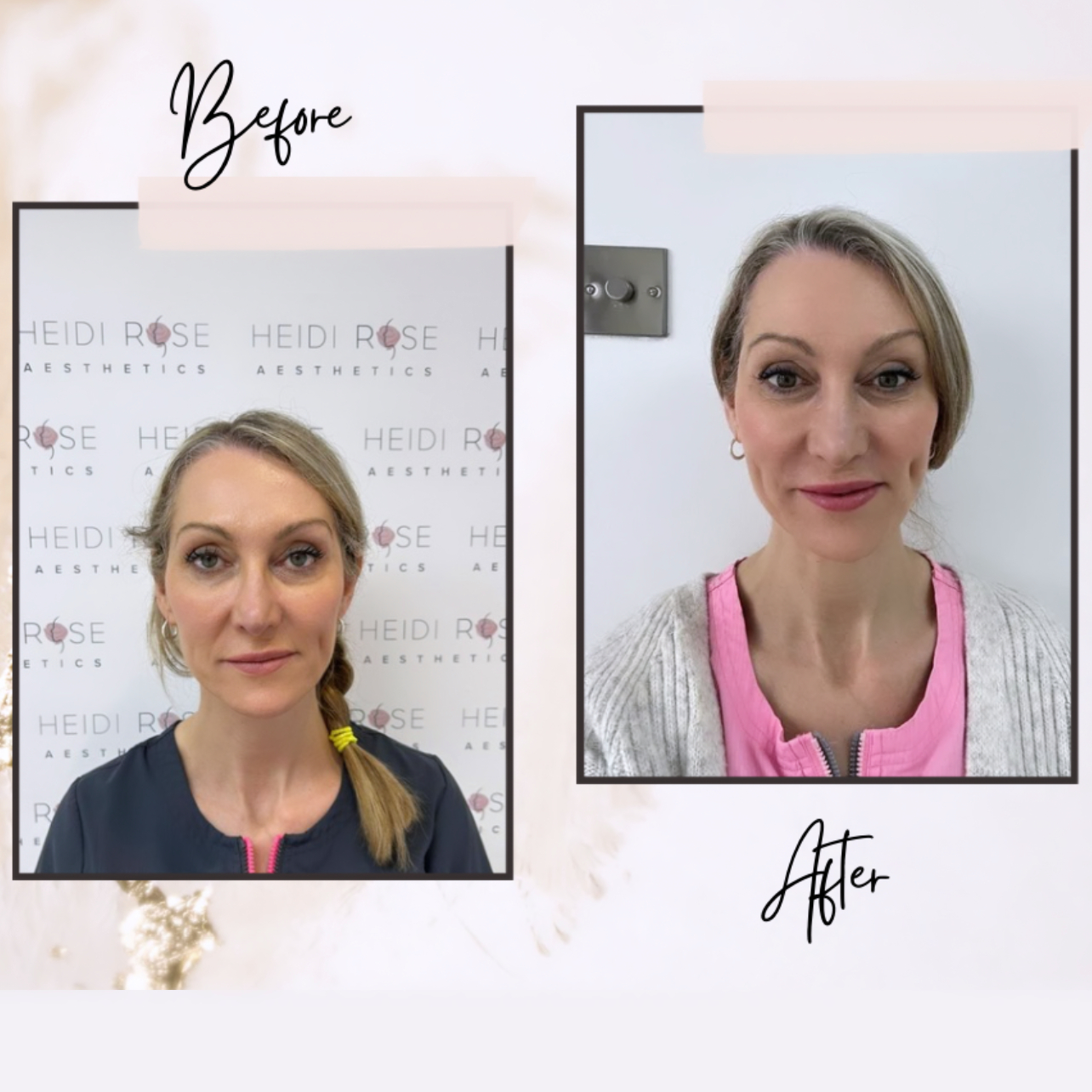 Isabella Medical Aesthetics clinic gallery image