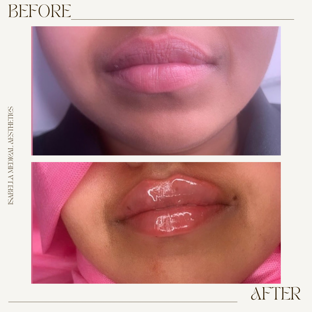 Isabella Medical Aesthetics clinic gallery image