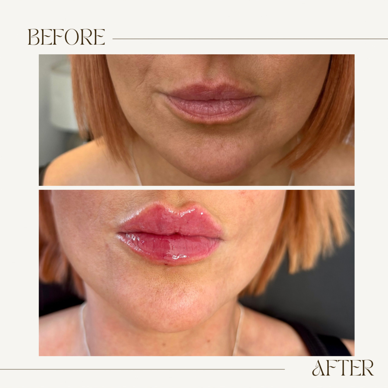 Isabella Medical Aesthetics clinic gallery image