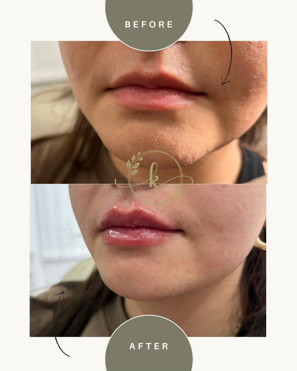 Isabella Medical Aesthetics clinic gallery image