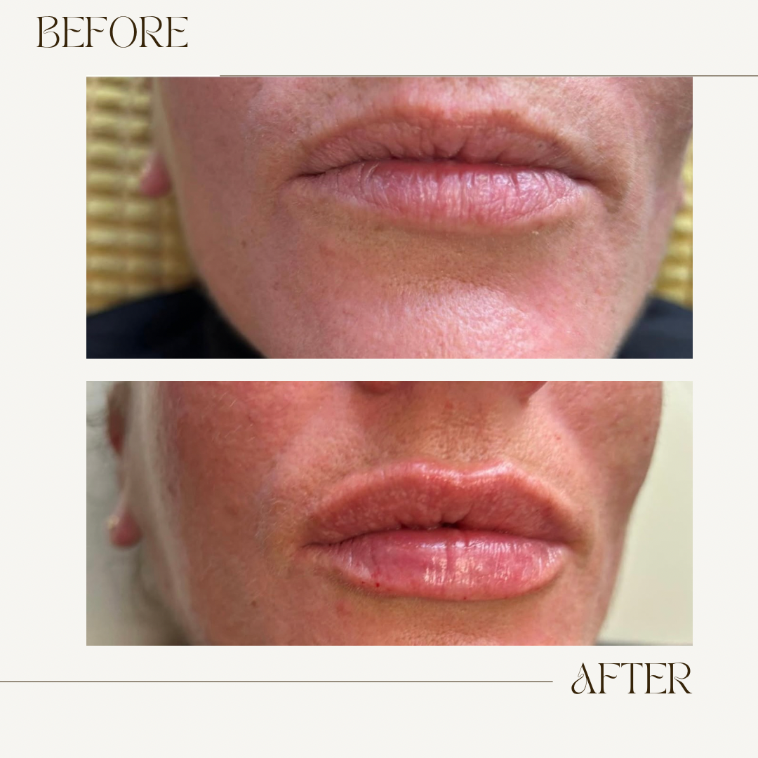 Isabella Medical Aesthetics clinic gallery image