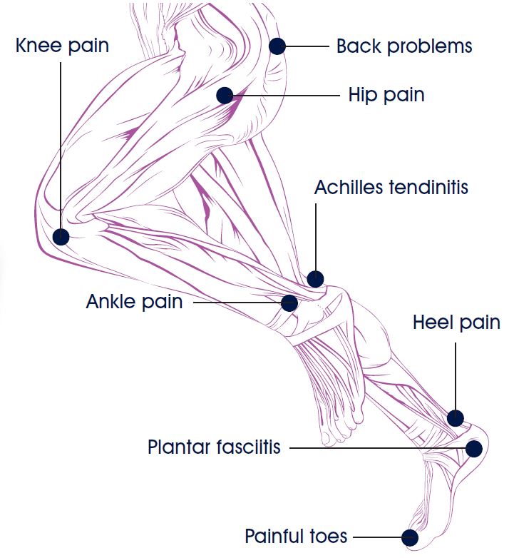 Podiatry foot treatment illustration from JT Podiatry
