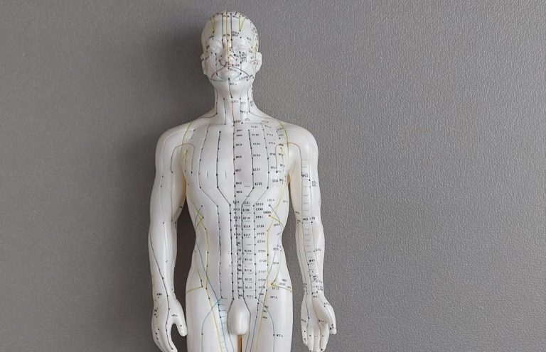 Acupuncture treatment in progress at Jude Ward Therapies