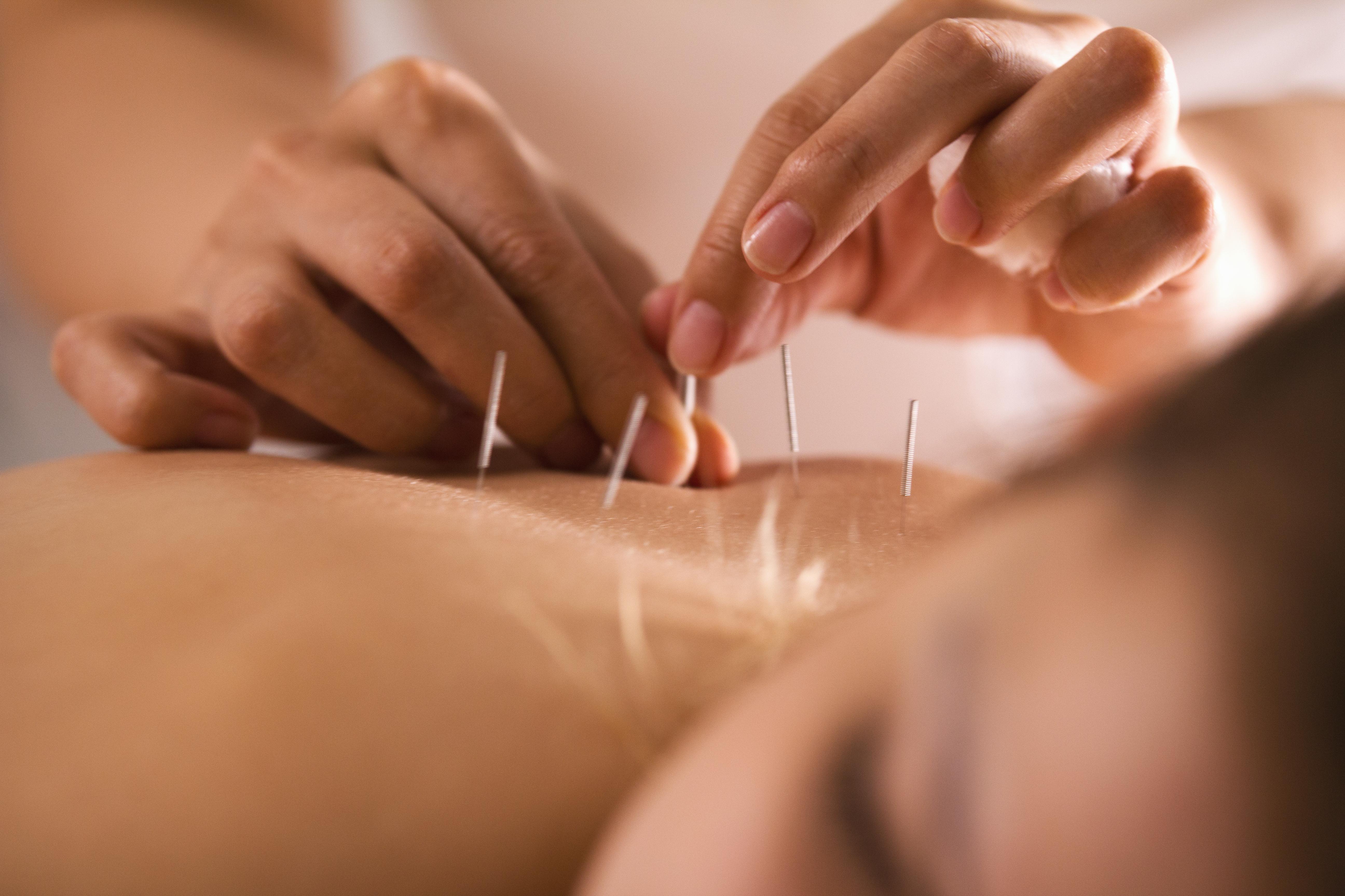 Inside Just Be Acupuncture