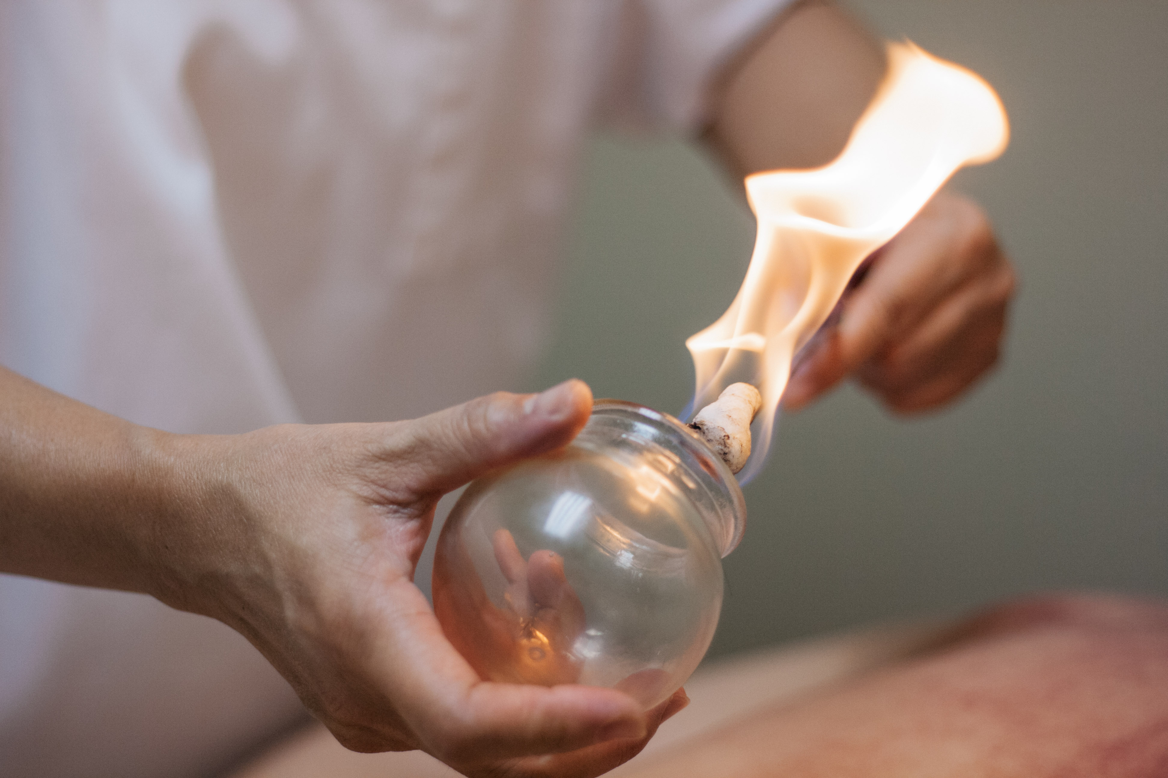Cupping Treatment Flash Cupping Fatigue Muscle Pain Migraine Sciatica