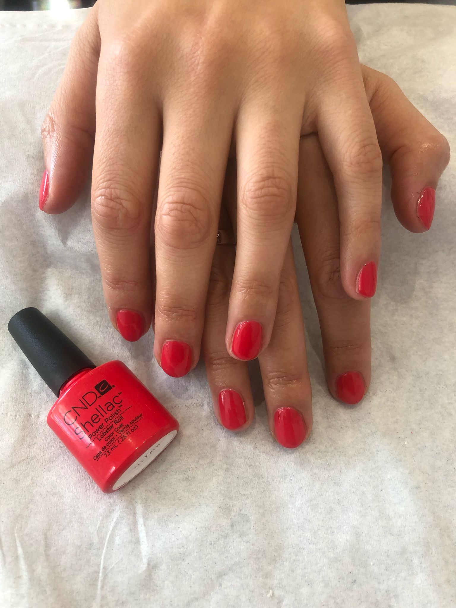 L'Exquise Beauty & Aesthetics treatment result photo