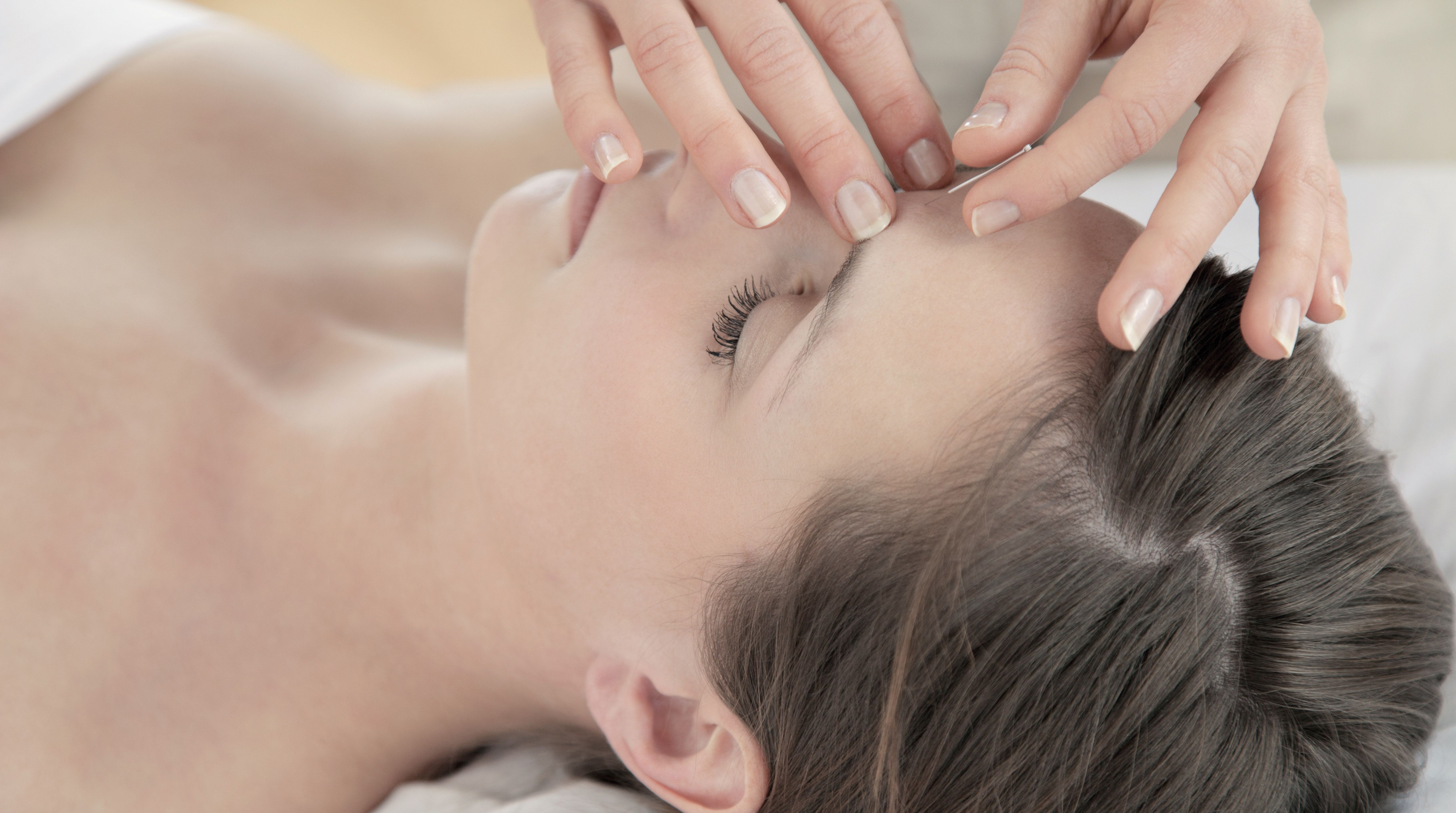 Acupuncture needle treatment in session
