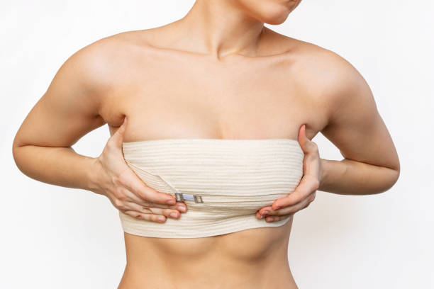 Breast surgery gallery image
