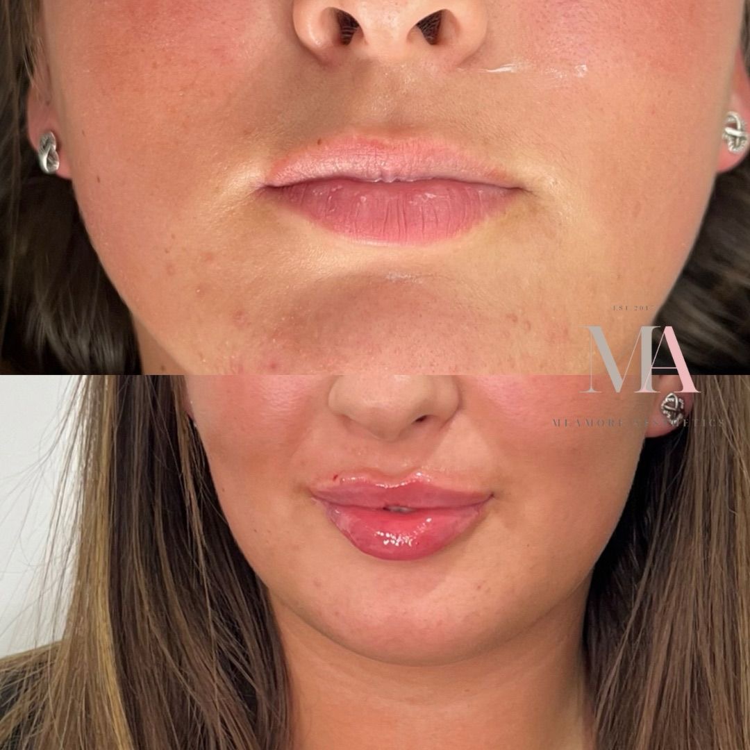 Meamore Aesthetics treatment showcase