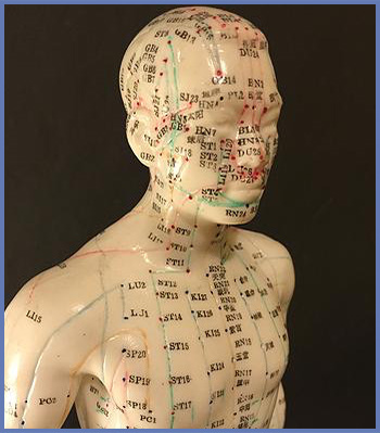 Acupuncture treatment imagery