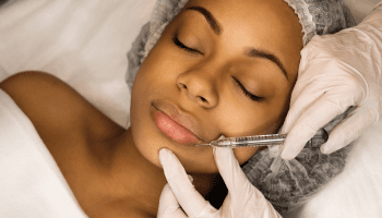 Dermal filler treatment image