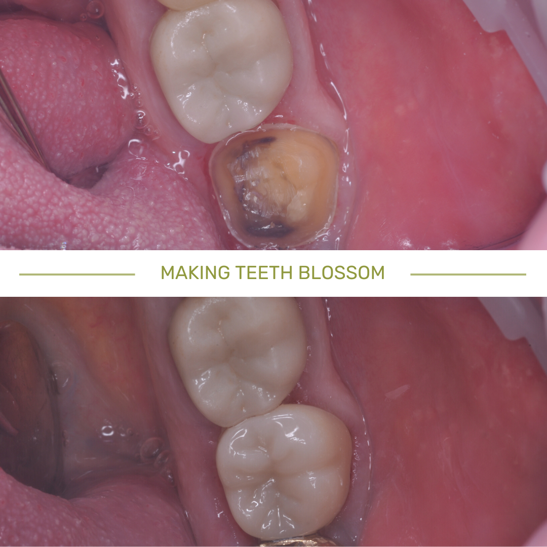 Inside Smile Orchard Dental Practice and Implant Centre