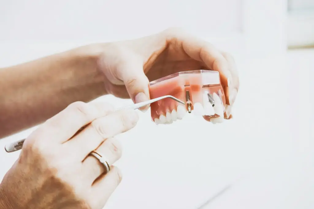 Dental treatment imagery (stock)