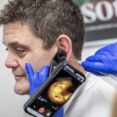 Ear wax removal using a Tympa device