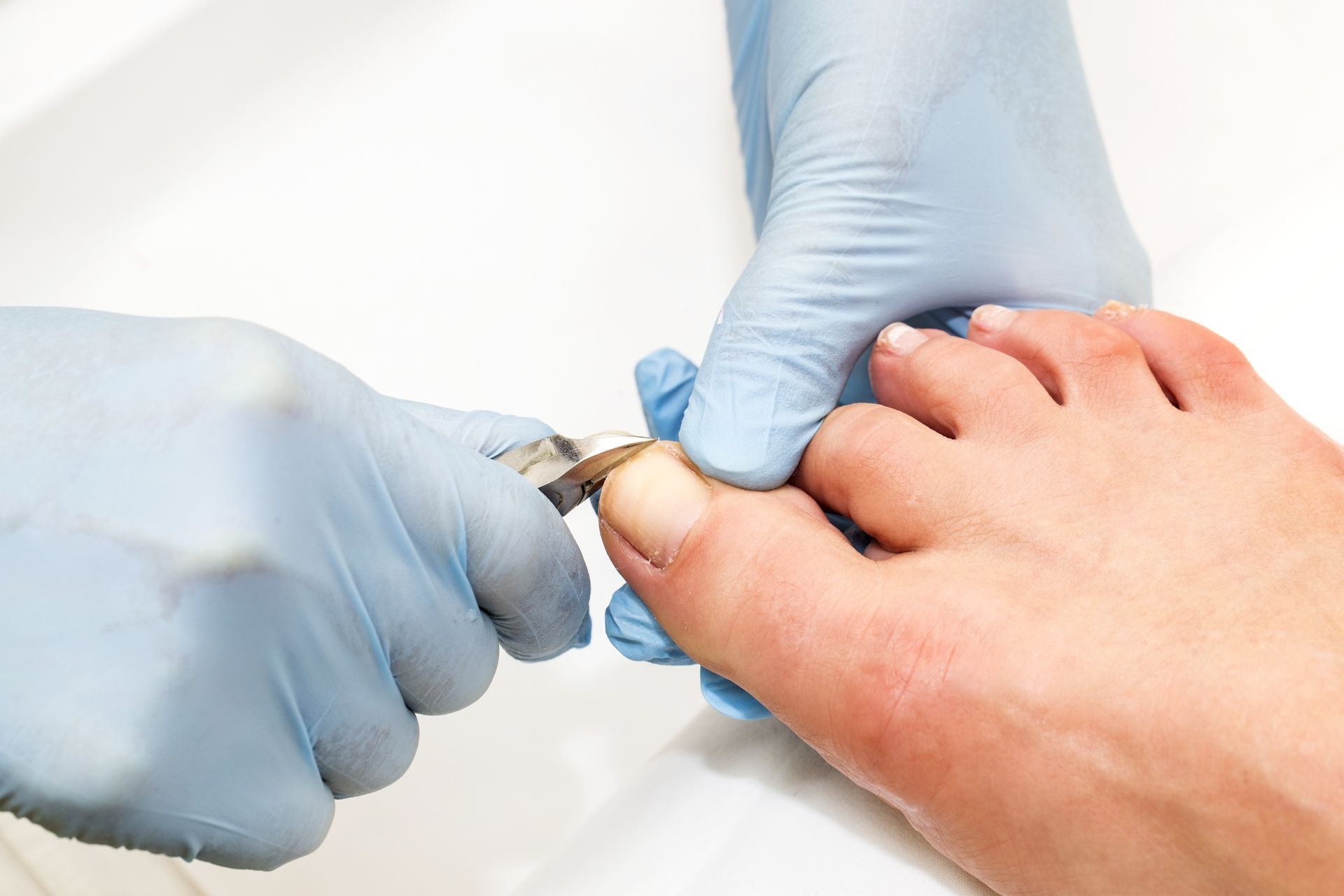Podiatry nail cutting treatment in progress