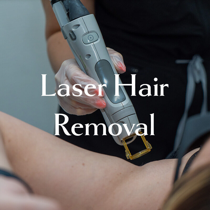 Laser hair removal treatment
